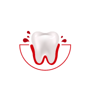 Quanto spesso ti sanguinano le gengive mentre ti lavi i denti o usi il filo interdentale?