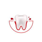 Quanto spesso ti sanguinano le gengive mentre ti lavi i denti o usi il filo interdentale?