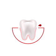 Quanto spesso ti sanguinano le gengive mentre ti lavi i denti o usi il filo interdentale?